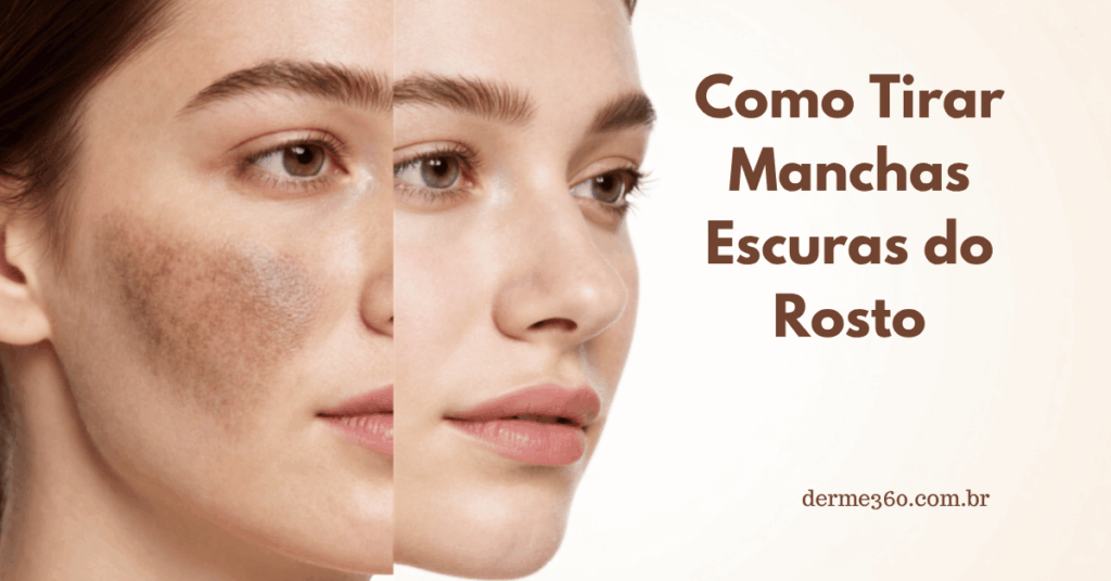 manchas escuras no rosto